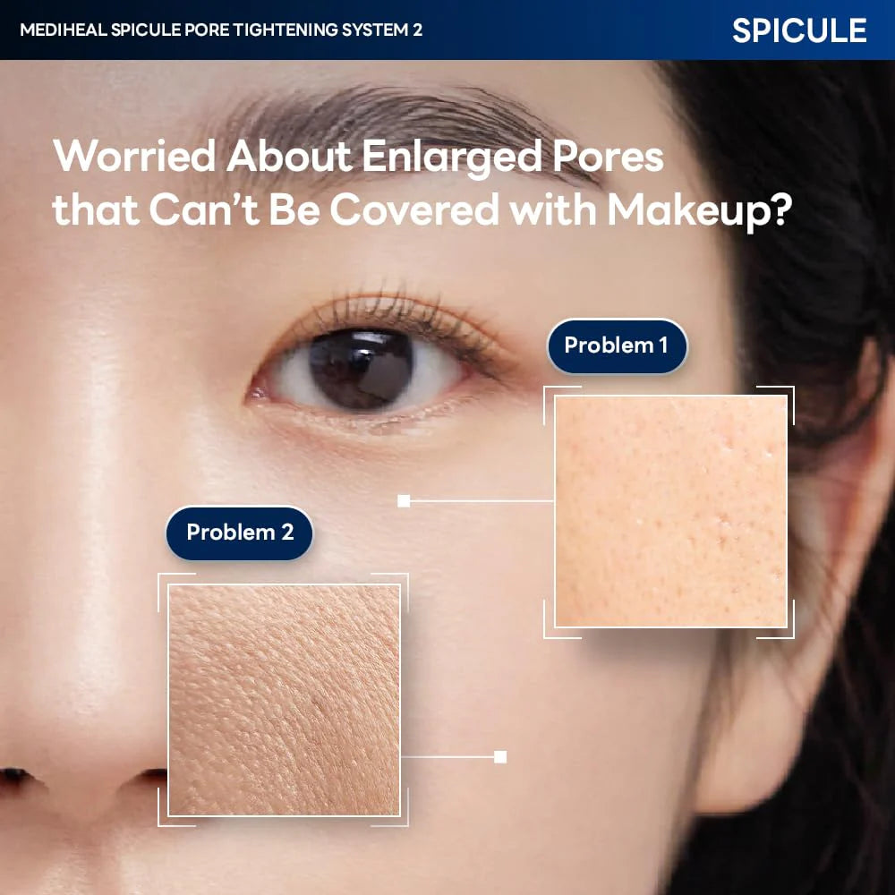 MEDIHEAL Spicule Pore Tightening System 1 Mask (4 Pcs)