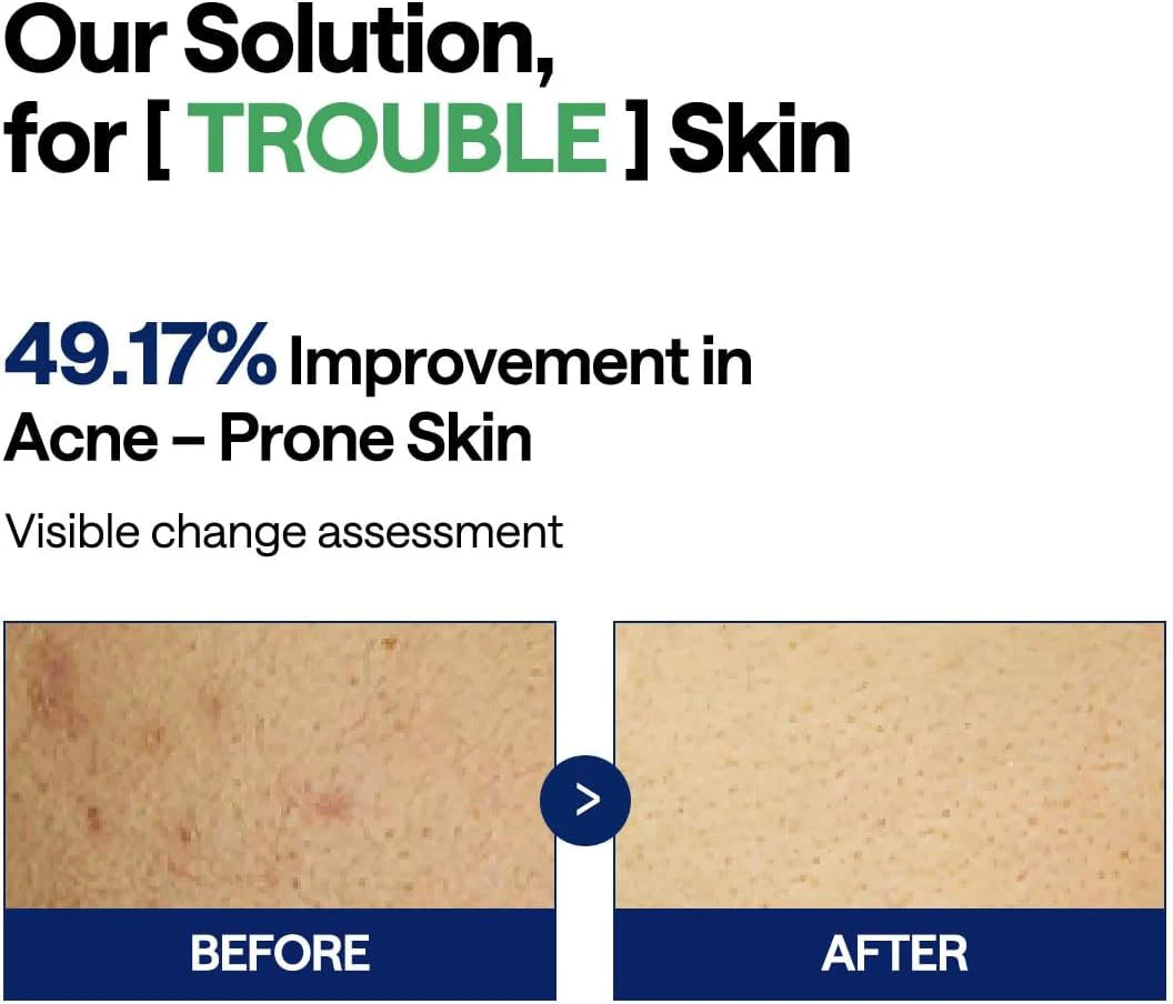 MEDIHEAL Teatree Trouble Pad (100 Pads)