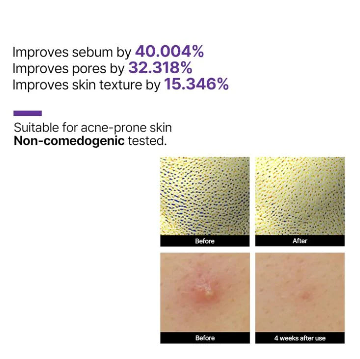 SOME BY MI 视黄醇抗老焕活精华 30ml 淡纹紧致 提亮肤质