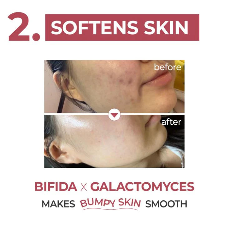 NUMBUZIN No. 3 Skin Softening Serum 50ml