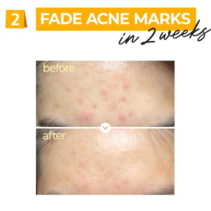 NUMBUZIN No.5 高浓维他命焕亮精华 30ml 淡斑提亮 焕活光泽