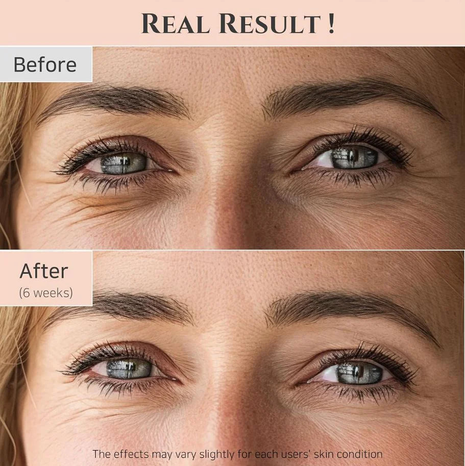 BEAUTY OF JOSEON淡纹眼霜 30ml