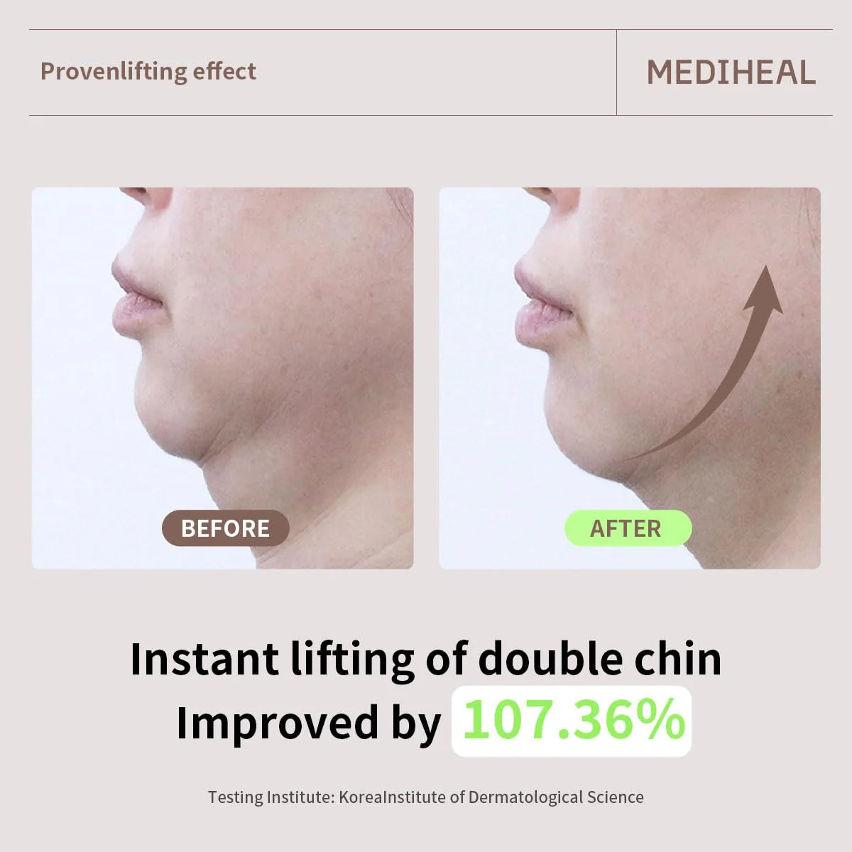 MEDIHEAL Retinol Collagen Cream Lifting Mask (4 Pcs)